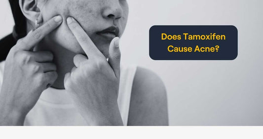 Does Tamoxifen Cause Acne?