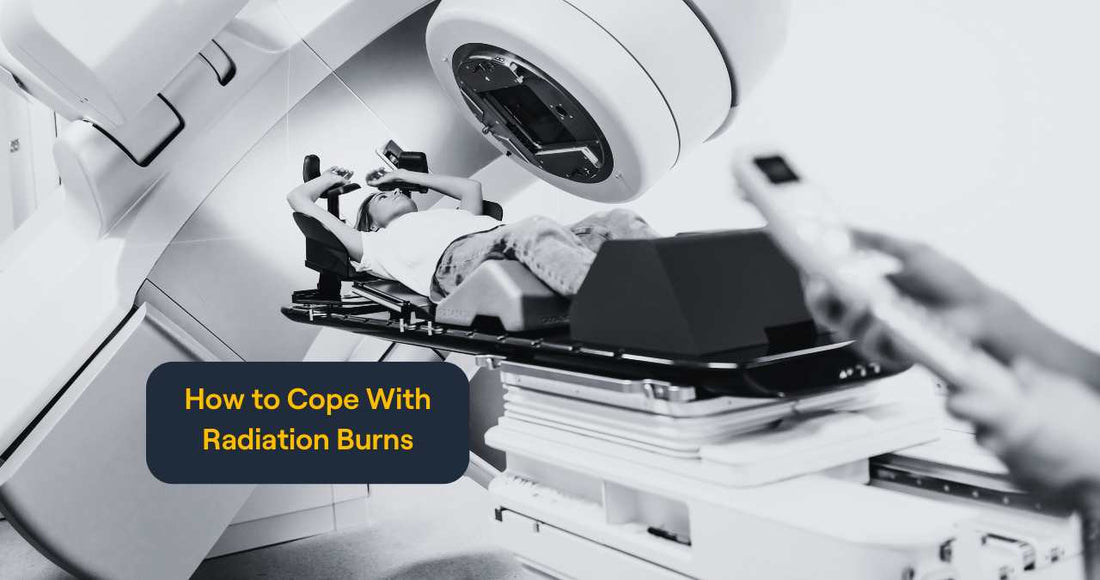 How to Cope With Radiation Burns