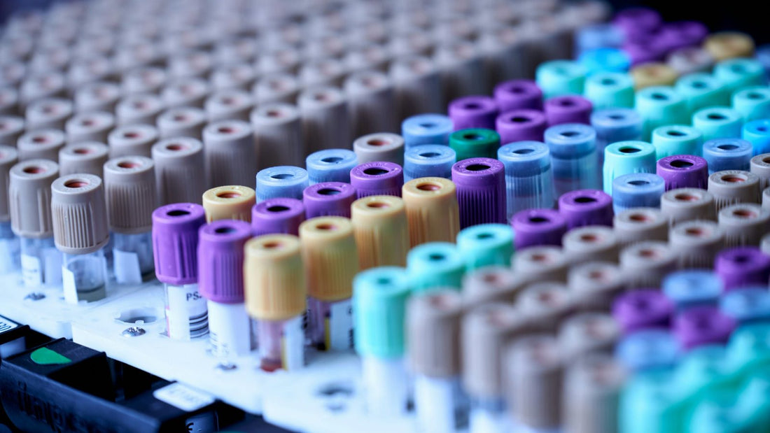 Rows of biomarker sample tubes with colored caps in a lab rack.