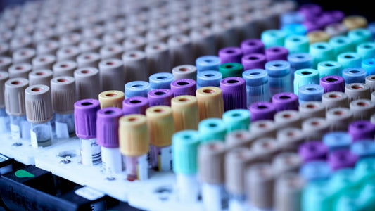 Rows of biomarker sample tubes with colored caps in a lab rack.